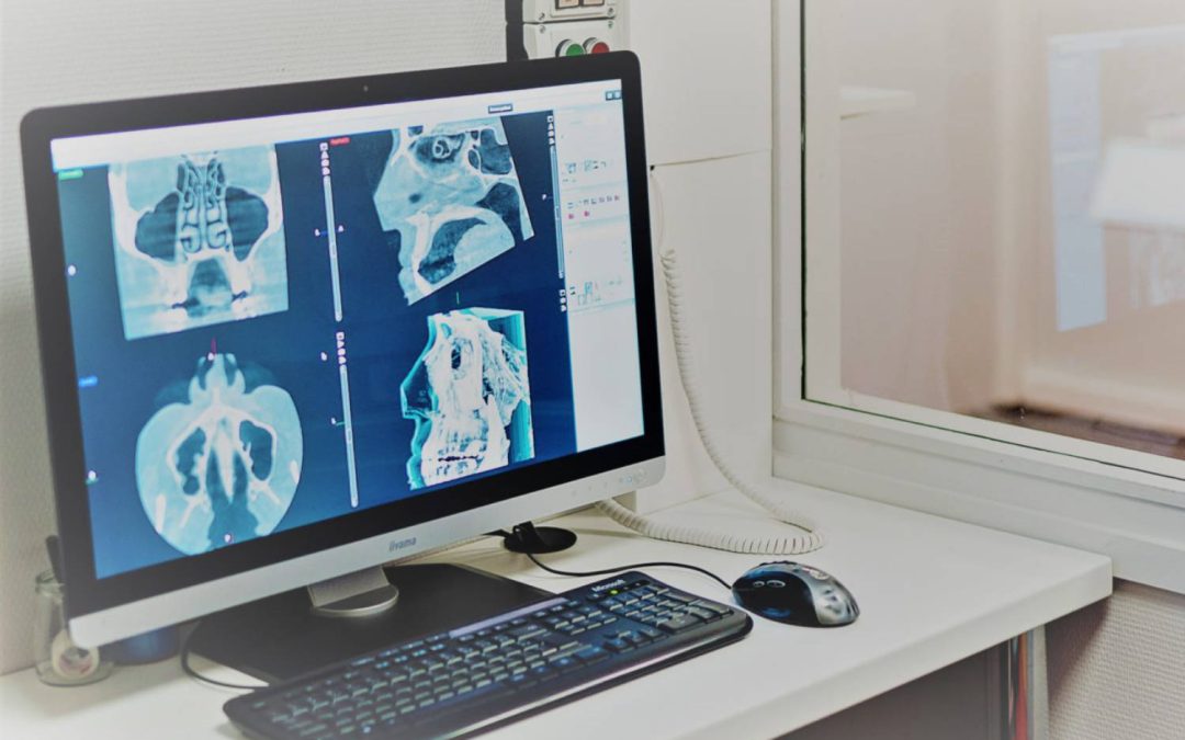 Cone Beam CT et panoramique dentaire