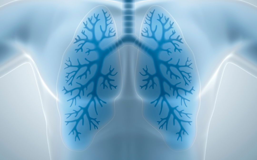 La scintigraphie pulmonaire