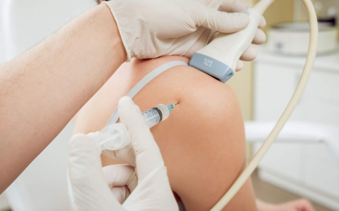 Infiltration sous échographie